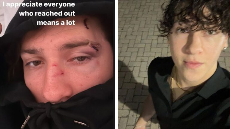 Kick streamer Jack Doherty left behind his cameraman with face injuries after a highway car crash!