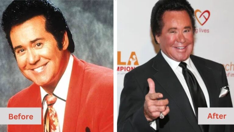 Wayne Newton’s plastic surgery stunned viewers after a cameo appearance in The Golden Bachelorette!