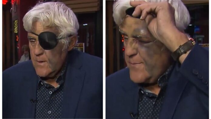 Jay Leno with an eye patch